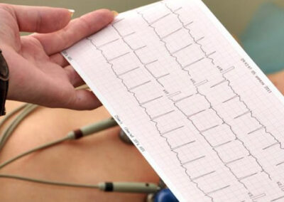 Seminario práctico de reciclaje en la interpretación de ECG
